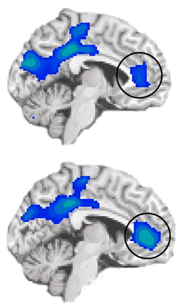 fMRI scans